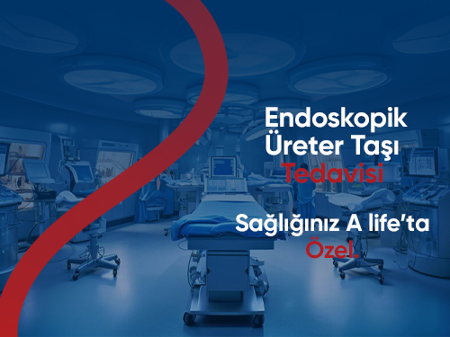 Flexible Lazer İle Endoskopik Üreter Taşı Tedavisi
